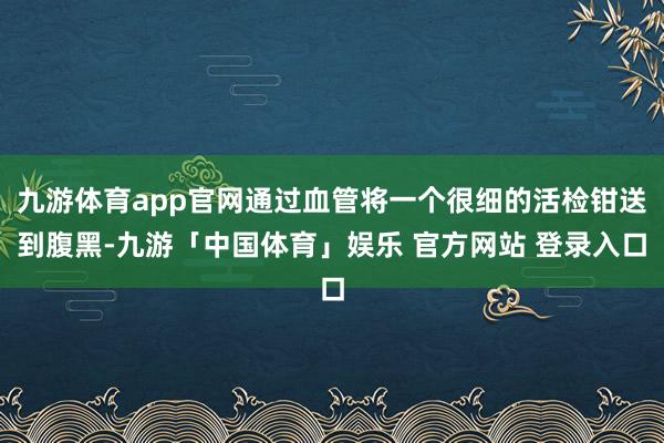 九游体育app官网通过血管将一个很细的活检钳送到腹黑-九游「中国体育」娱乐 官方网站 登录入口