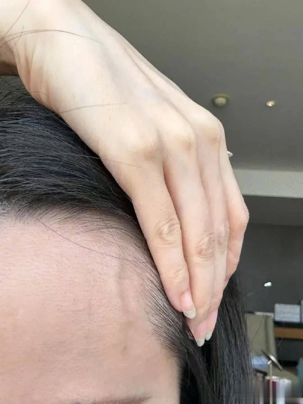 九游体育官网登录入口轻断食必须坚握21天……一套组合拳下来-九游「中国体育」娱乐 官方网站 登录入口